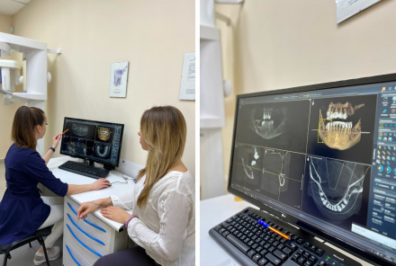 Зачем нужна костная пластика