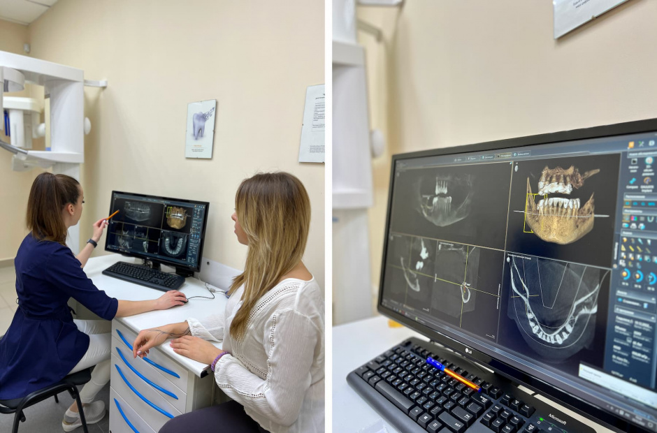 Зачем нужна костная пластика