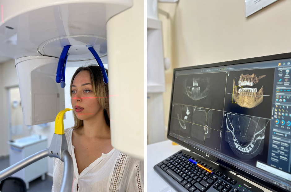 Рентген зуба в Красноярске